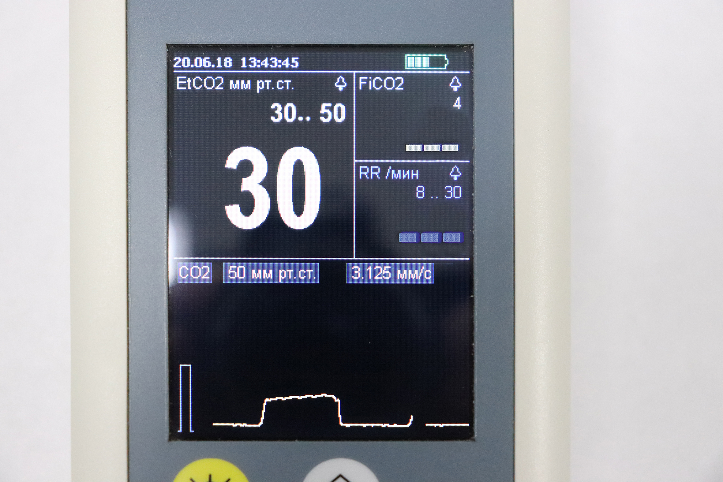 Монитор СО2 портативный реанимационный «Капнотест»