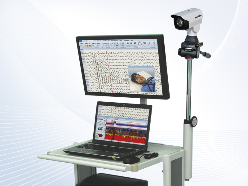 Комплект видеооборудования для ЭЭГ-видеомониторинга  и ПМО «Энцефалан-Видео»